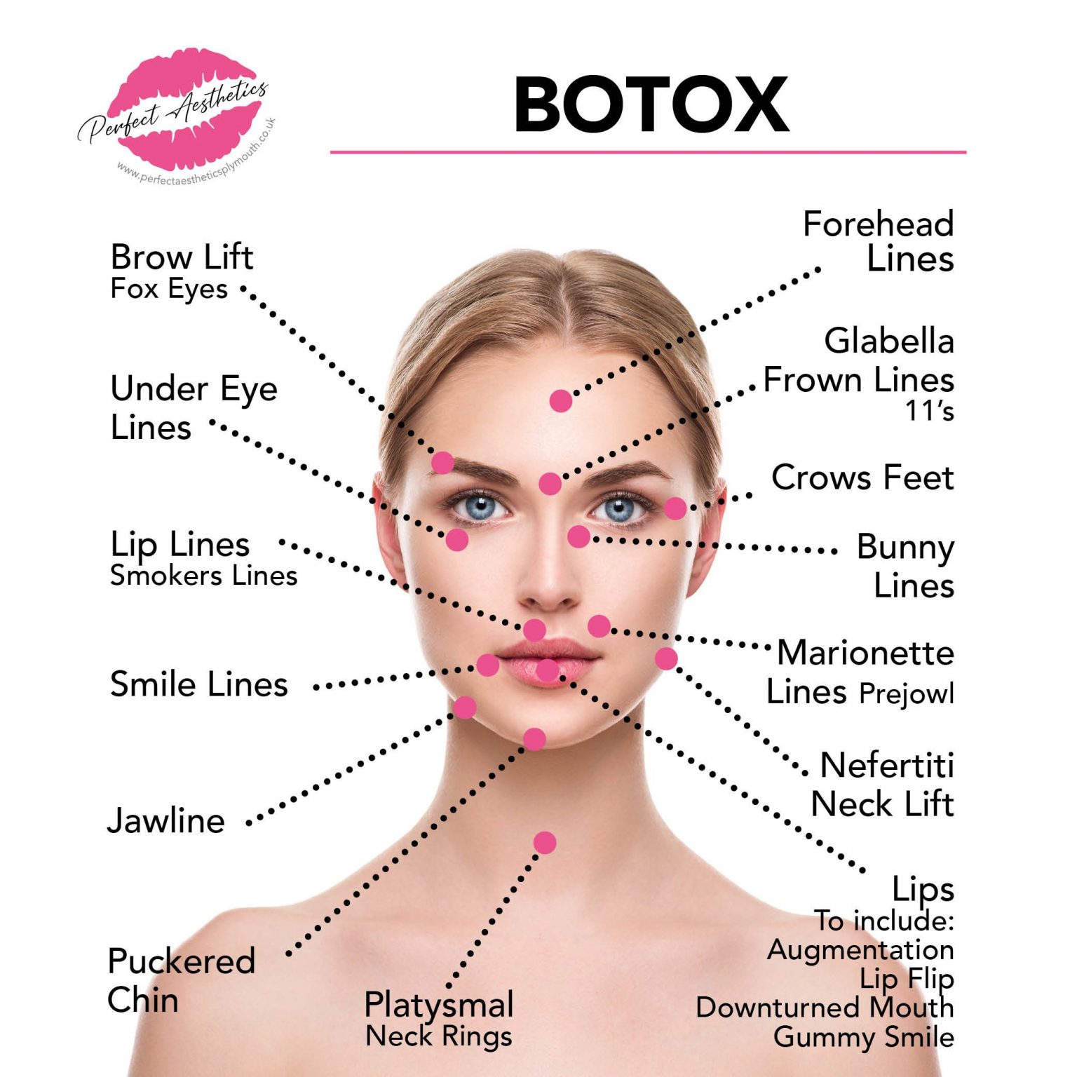 Plymouth Botox – Your Questions Answered - Perfect Aesthetics Plymouth